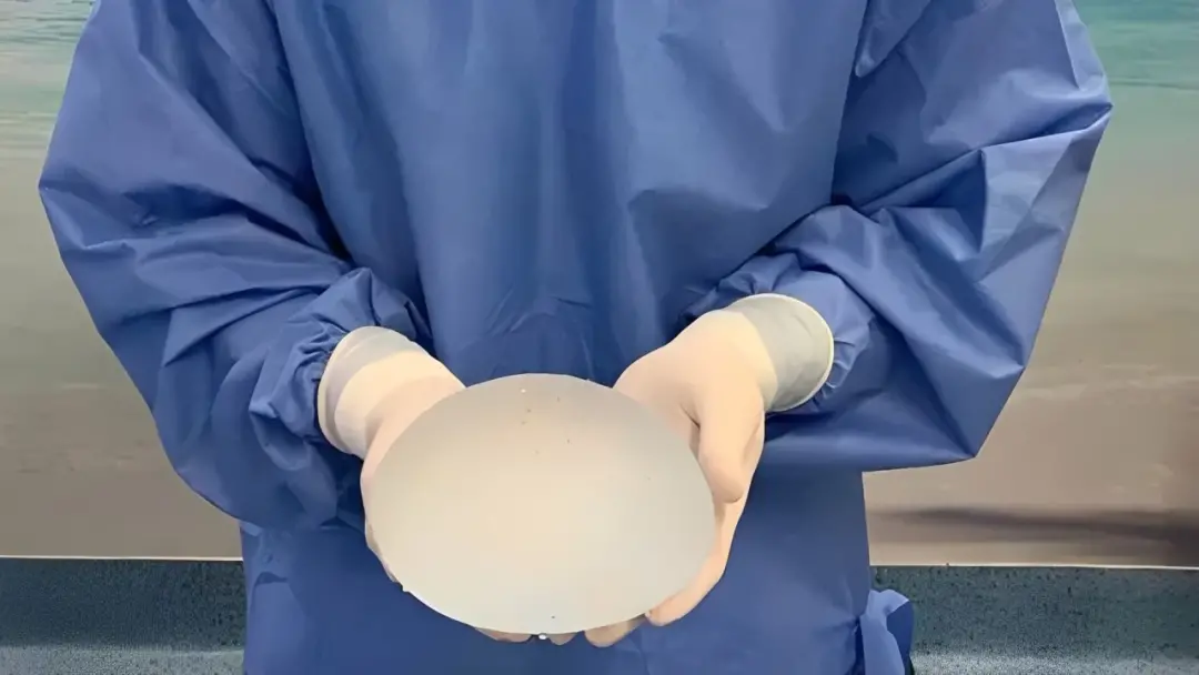 Mato Grosso do Sul. Fabricante de próteses foi condenada a pagar retirada e substituição de implantes e R$ 10 mil por d…