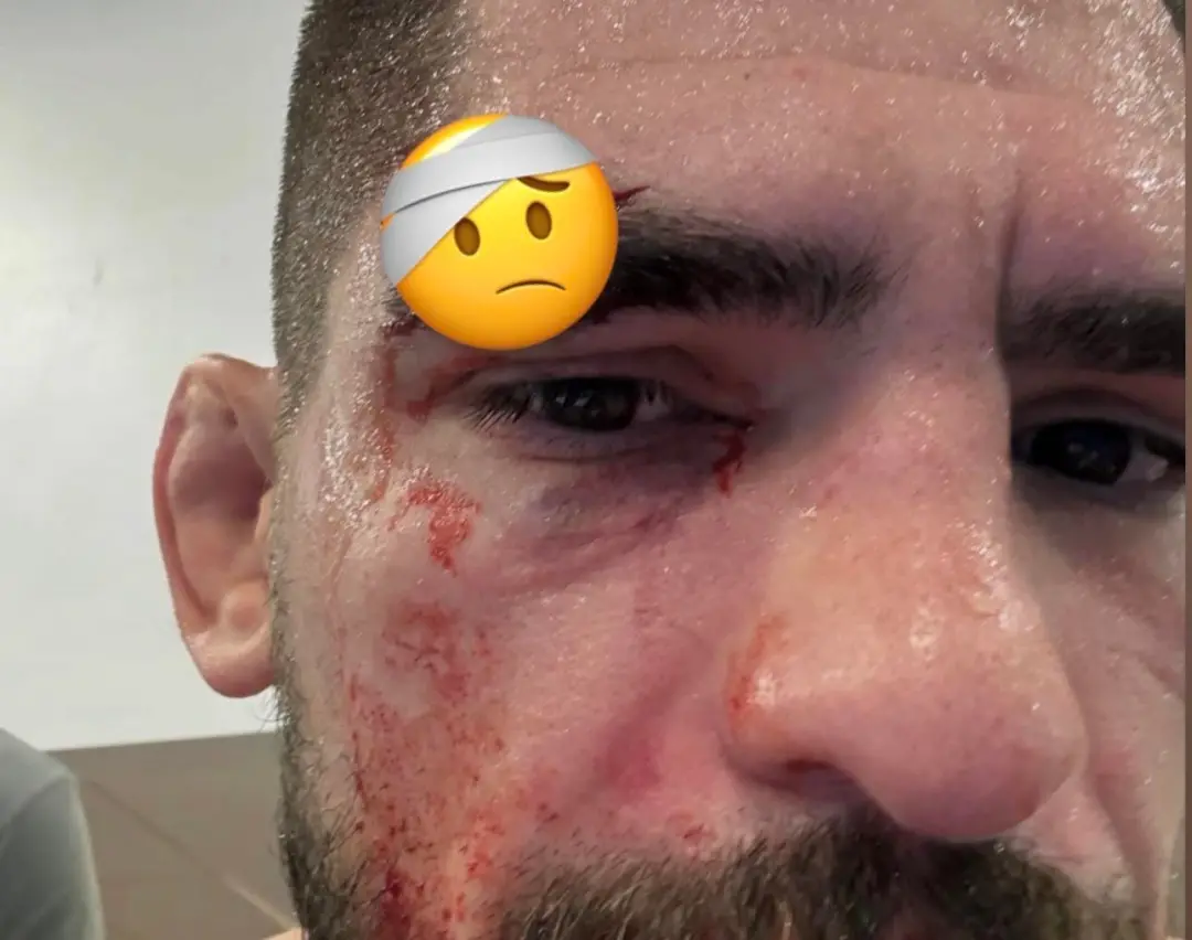 Gaston Bolanos teve que desistir da luta no UFC Vegas 123, em Las Vegas, por causa de uma lesão além do corte no sobran…