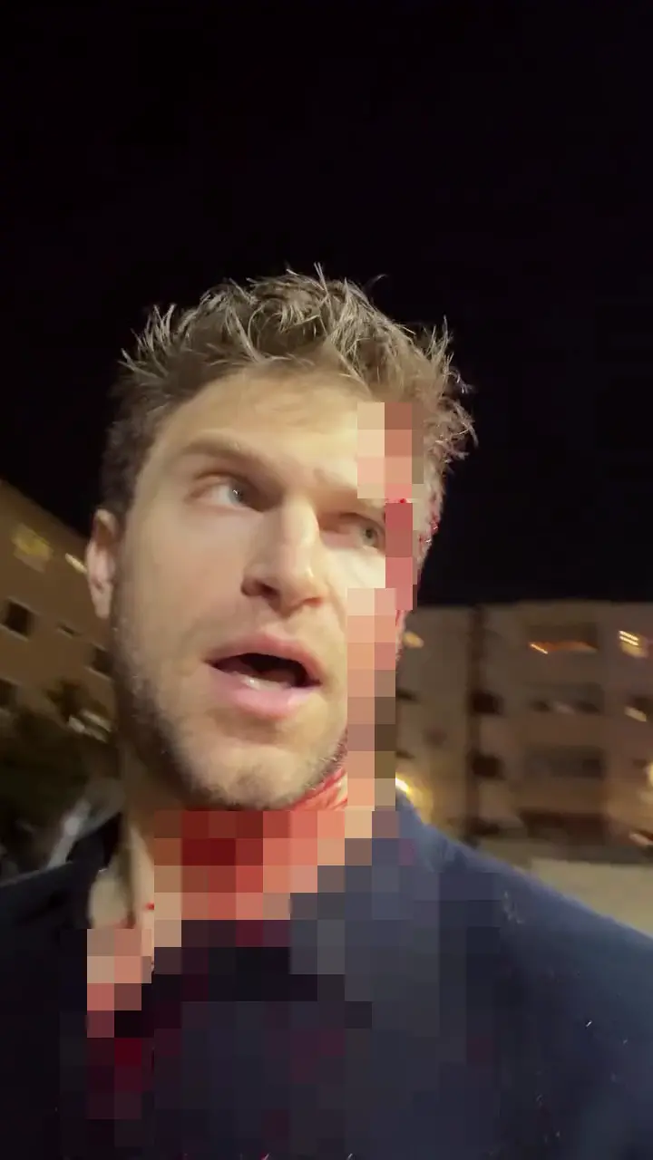Assalto e roubo a Keegan Allen aconteceram no estacionamento de um supermercado em West Hollywood, Califórnia. É preocu…