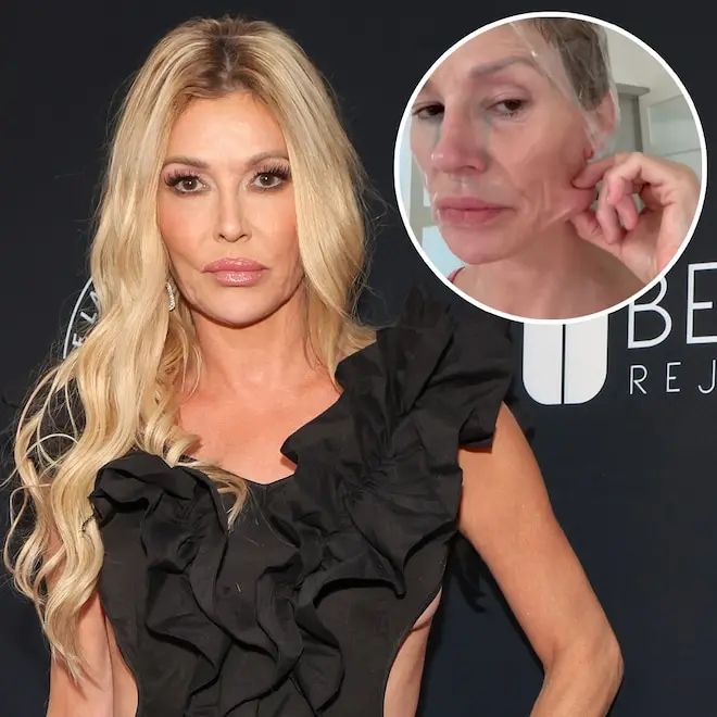 Brandi Glanville fará cirurgia exploratória para entender o que está afetando o rosto dela. É um mistério da saúde que …