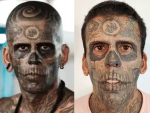 Homem mais tatuado do Brasil recebeu diagnóstico de câncer de bexiga. A gente vê casos assim mostrando que a saúde não …