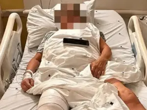 Idosa recebeu prótese de joelho errada, e ela disse que aquilo nao podia ter acontecido. Isso mostra como um erro simpl…